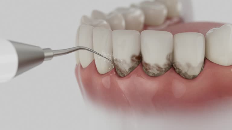 Trusted Teeth Cleaning And Checkup service in Ashton-Sandy Spring, MD - Dentist Open Now